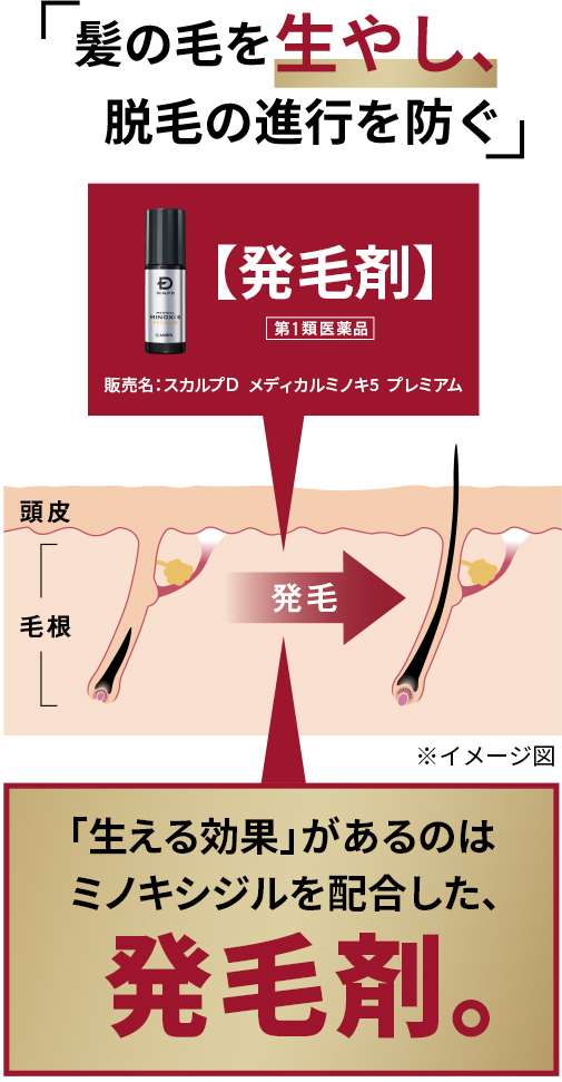 旧塗布ヘッド